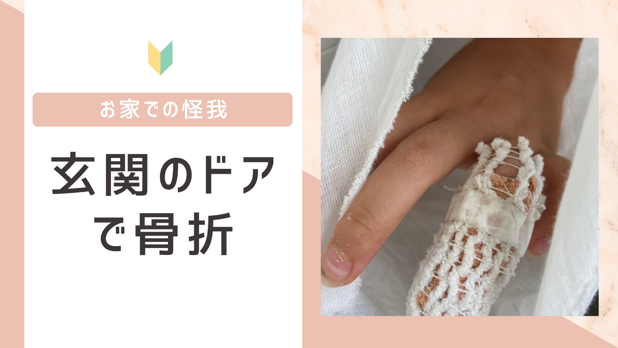 玄関ドアで骨折！自宅で大けがをしてしまった